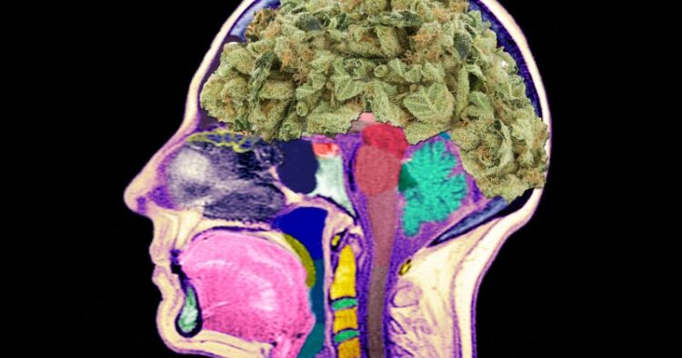 Ganja hjärna