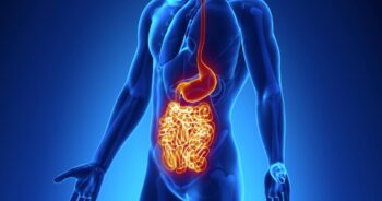 Crohns sjukdom