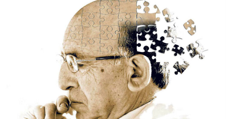 Alzheimers